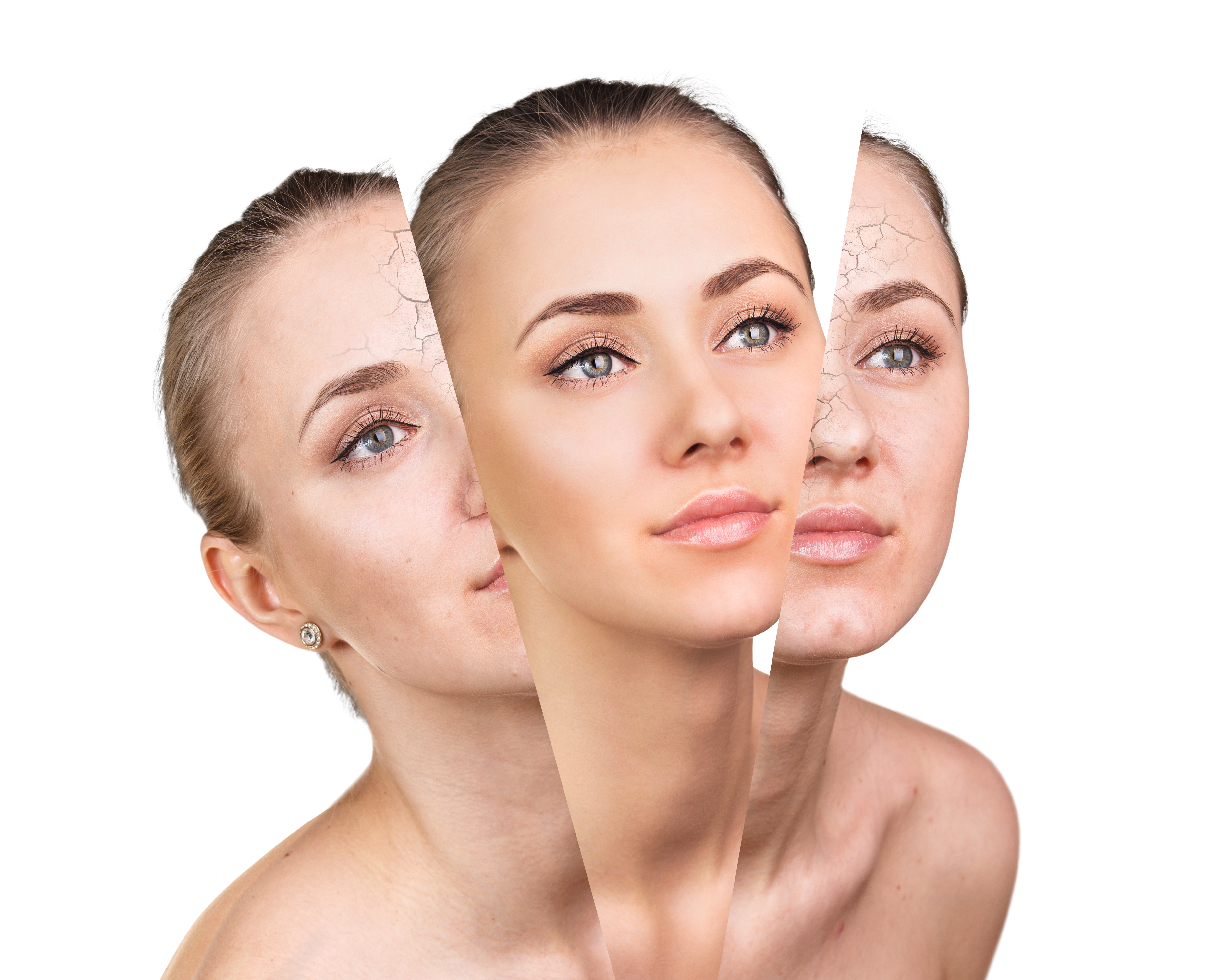 Revitalización facial